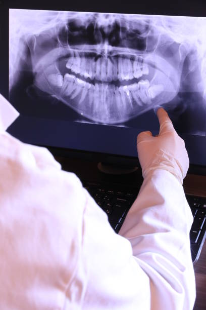 Best Emergency Dental Extractions in Pine Mountain Lake, CA