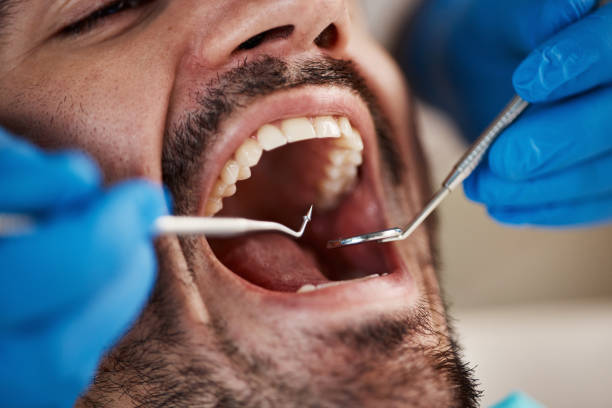 Best Emergency Dental Services for Seniors in Pine Mountain Lake, CA